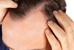 Hair Restoration in Boston, MA